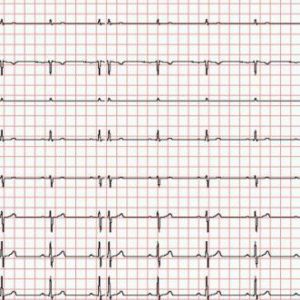 Diagramm Halbach Registrierpapier für EKG Cardio-M-Plus