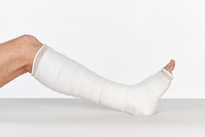 COM - TeX® Soft Synthetische Polsterbinde 6 cm | 12.0