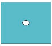 Mölnlycke BARRIER® Lochtuch