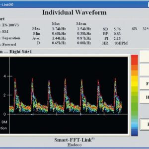 Hadeco Bidop™ ES-100V3 Taschendoppler mit PPG-Sonde