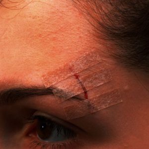 3M™ STERI - STRIP™ BLENDTONE