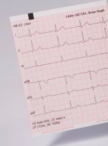 EKG-Papier für SCHILLER Cardiovit FT-1