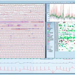 Darwin EKG-Arrhythmie-Analyse für SCHILLER Domino