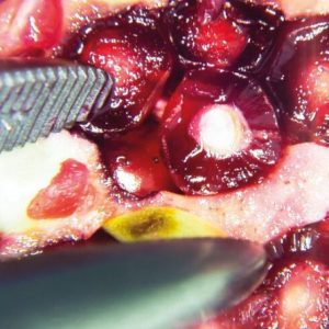 SCHMITZ vidan® 2 Full - HD Videokolposkop