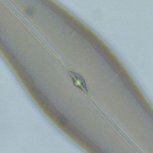 124898.jpg Helmut Hund medicus pro Myko Fluoreszenz-Mikroskop