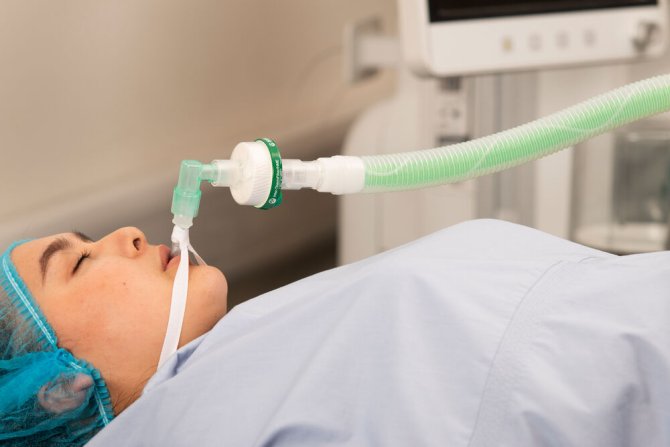 Intersurgical Uniflow™ Koaxial - Beatmungssystem