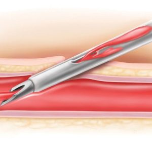 129143.jpg Becton Dickinson Insyte™ Autoguard™ Sicherheitsvenenverweilkatheter mit Flügeln