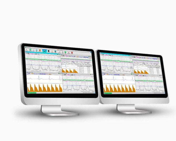 MFM-CNS Lite Central Monitoring Software zu Edan F3 Fetalmonitor