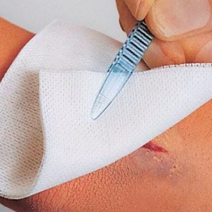 152913.jpg Lohmann&Rauscher Vliwasoft® Vliesstoffkompresse